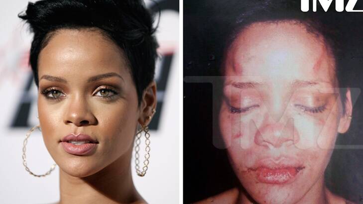 Familiar? ... Rihanna and the now-infamous police picture of her after Brown's assault.