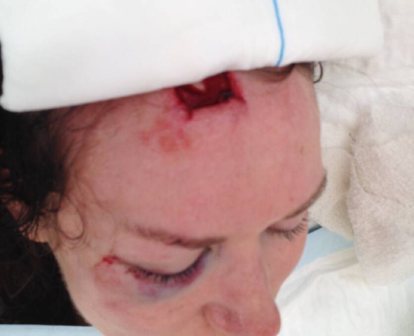Alice Johnson at John Hunter Hospital after she was hit by the gazebo.